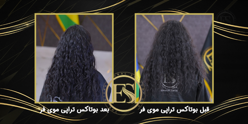 قبل و بعد بوتاکس ترای موی فر